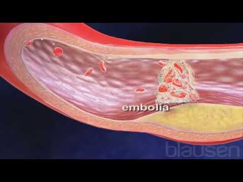 immagine di anteprima del video: modulo 5 - elementi di primo soccorso